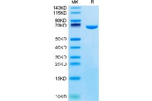 Mouse Serum Albumin on Tris-Bis PAGE under reduced condition. (Albumin Protein (ALB) (AA 25-608) (His tag))