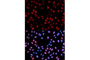 Immunofluorescence analysis of U2OS cells using Phospho-RAF1-S621 antibody (ABIN5969931). (RAF1 Antikörper  (pSer621))