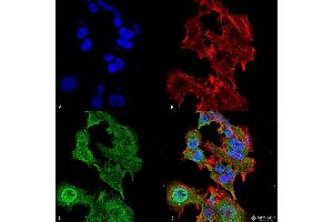 Immunocytochemistry/Immunofluorescence analysis using Mouse Anti-GFAP Monoclonal Antibody, Clone S206A-8 . (GFAP Antikörper  (AA 411-422) (Atto 594))