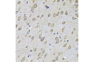Immunohistochemistry of paraffin-embedded mouse brain using NFU1 Antibody (ABIN2564134) at dilution of 1:100 (40x lens). (NFU1 Antikörper)