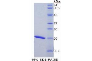 SDS-PAGE (SDS) image for Cyclophilin B (PPIB) (AA 34-216) protein (His tag) (ABIN1079325) (PPIB Protein (AA 34-216) (His tag))