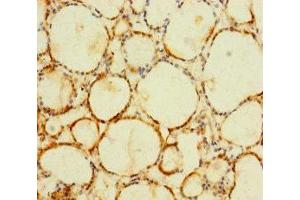 Immunohistochemistry of paraffin-embedded human thyroid tissue using ABIN7174776 at dilution of 1:100 (C1orf112 Antikörper  (AA 301-530))
