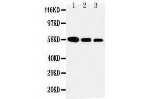Anti-AHSG antibody, Western blotting Lane 1: Recombinant Human Fetuin A Protein 10ng Lane 2: Recombinant Human Fetuin A Protein 5ng Lane 3: Recombinant Human Fetuin A Protein 2. (Fetuin A Antikörper  (N-Term))