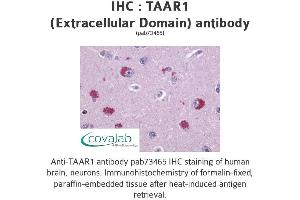Image no. 1 for anti-Trace Amine Associated Receptor 1 (TAAR1) (2nd Extracellular Domain) antibody (ABIN1739852) (TAAR1 Antikörper  (2nd Extracellular Domain))