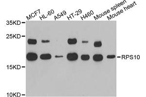 Western blot analysis of extracts of various cell lines, using RPS10 antibody. (RPS10 Antikörper)