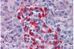 Human Pancreas (formalin-fixed, paraffin-embedded) stained with BID antibody ABIN343922 at 5 ug/ml followed by biotinylated goat anti-rabbit IgG secondary antibody ABIN481713, alkaline phosphatase-streptavidin and chromogen. (BID Antikörper)