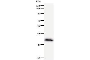 Western Blotting (WB) image for anti-Calcium And Integrin Binding Family Member 2 (CIB2) antibody (ABIN930952) (CIB2 Antikörper)