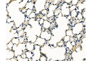 ABIN6260447 and ABIN6279233 at 1/100 staining mouse lung tissue by IHC-P.