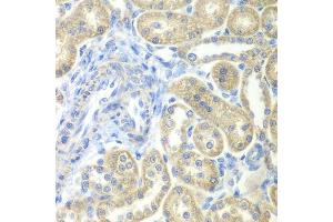 Immunohistochemistry of paraffin-embedded rat kidney using NDUFV2 antibody. (NDUFV2 Antikörper  (AA 1-249))