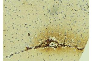ABIN6279617 at 1/100 staining Mouse brain tissue by IHC-P. (DFNA5 Antikörper  (C-Term))