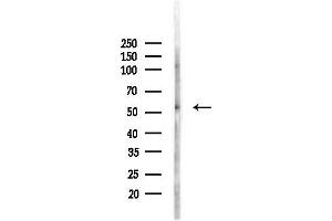 Western blot analysis of lysates from PC12 cells(LPS, 4h treatment), using FOXF1 Antibody at 1/1000 dilution.