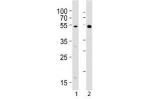 Western Blotting (WB) image for anti-V-Yes-1 Yamaguchi Sarcoma Viral Related Oncogene Homolog (LYN) (AA 229-263) antibody (ABIN3032775)