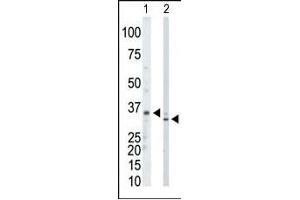 The anti-PRPS1/2/3 Pab (ABIN391076 and ABIN2841223) is used in Western blot to detect PRPS1/2/3 in mouse kidney tissue lysate (Lane 1) and Hela cell lysate (Lane 2). (PRPS1,PRPS2,PRPS3 (AA 79-109), (N-Term) Antikörper)