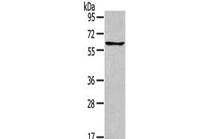 Western Blot analysis of Jurkat cells using GLP2R Polyclonal Antibody at dilution of 1:400 (GLP2R Antikörper)