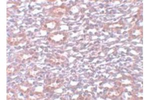 Immunohistochemical staining of rat kidney tissue with PIAS1 polyclonal antibody  at 5 ug/mL dilution. (PIAS1 Antikörper  (C-Term))