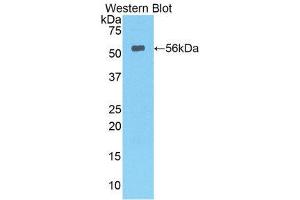 Western Blotting (WB) image for anti-Lipase, Hepatic (LIPC) (AA 103-356) antibody (ABIN1078291)