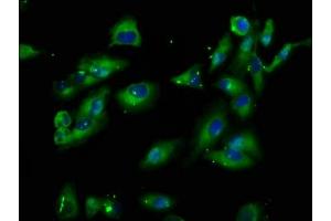 Immunofluorescence staining of Hela cells with ABIN7163303 at 1:100, counter-stained with DAPI. (PIK3IP1 Antikörper  (AA 22-168))