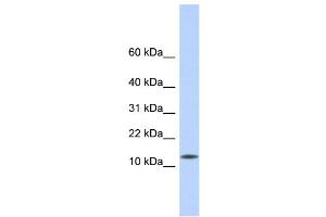WB Suggested Anti-CDRT4 Antibody Titration: 0. (CDRT4 Antikörper  (Middle Region))