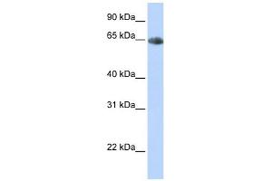 SLC6A2 antibody used at 1 ug/ml to detect target protein. (SLC6A2 Antikörper)