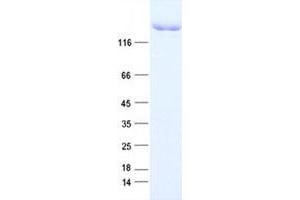 KDM5A Protein (DYKDDDDK Tag)