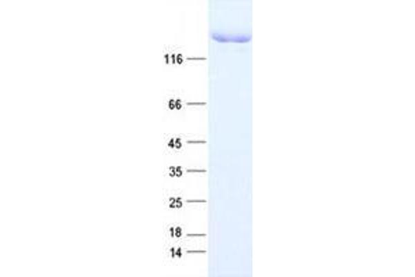 KDM5A Protein (DYKDDDDK Tag)