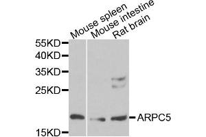 Western blot analysis of extracts of various cells, using ARPC5 antibody. (ARPC5 Antikörper)