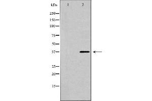Western blot analysis of extracts of HeLa , using CTGF antibody. (CTGF Antikörper  (Internal Region))