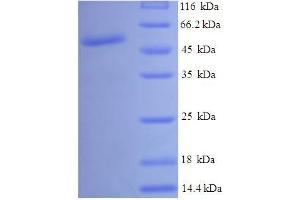 SDS-PAGE (SDS) image for UDP-Galactose-4-Epimerase (GALE) (AA 1-348), (full length) protein (His-SUMO Tag) (ABIN4975737) (GALE Protein (AA 1-348, full length) (His-SUMO Tag))