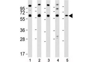 Western blot testing of Pyruvate Kinase antibody at 1:2000 dilution. (PKM2 Antikörper  (AA 121-151))