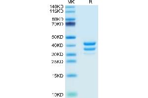 SDS-PAGE (SDS) image for Tumor Necrosis Factor Receptor Superfamily, Member 13C (TNFRSF13C) (AA 10-71) protein (Fc Tag) (ABIN7273917)