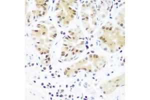 Immunohistochemistry of paraffin-embedded human stomach using AGO2 antibody (ABIN5973585) at dilution of 1/100 (40x lens). (AGO2 Antikörper)
