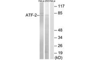 Western blot analysis of extracts from HeLa/293 cells, using ATF-2 (Ab-472) Antibody. (ATF2 Antikörper  (AA 441-490))