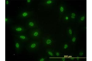 Immunofluorescence of monoclonal antibody to SMAD3 on HeLa cell.