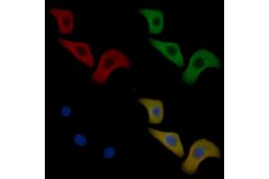 EPHA1 Mouse Monoclonal Antibody staining Hela cells by IF/ICC.