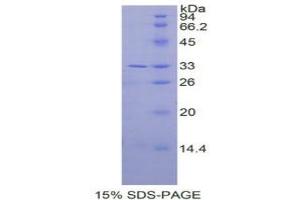 SDS-PAGE analysis of Human IL31RA Protein. (IL31RA Protein)