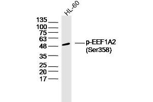 HL60 lysates probed with EEF1A2 (Ser358) Polyclonal Antibody, Unconjugated  at 1:300 dilution and 4˚C overnight incubation. (EEF1A2 Antikörper  (pSer358))