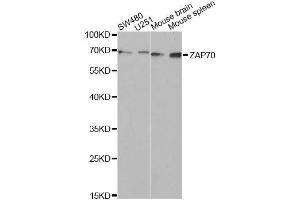 Western blot analysis of extracts of various cell lines, using ZAP70 Antibody. (ZAP70 Antikörper  (AA 1-300))