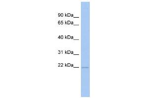 WB Suggested Anti-RWDD4A Antibody Titration: 0. (RWDD4A Antikörper  (N-Term))
