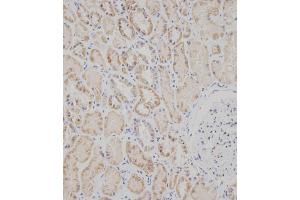 Immunohistochemical analysis of B on paraffin-embedded Human kidney tissue was performed on the Leica®BOND RXm. (SPHK2 Antikörper  (C-Term))