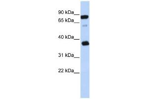 BCAP29 antibody used at 1 ug/ml to detect target protein. (BCAP29 Antikörper  (Middle Region))