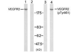 Western blot analysis of extracts from SK-OV3 cells using VEGFR2 (Ab-951) antibody (E021079, Line 1 and 2) and VEGFR2 (phospho-Tyr951) antibody (E011086, Line 3 and 4). (VEGFR2/CD309 Antikörper  (pTyr951))