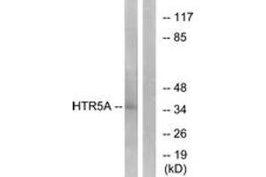 Western Blotting (WB) image for anti-Serotonin Receptor 5A (HTR5A) (AA 15-64) antibody (ABIN2890747) (Serotonin Receptor 5A Antikörper  (AA 15-64))