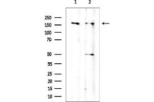 Western blot analysis of lysates from various samples, using TOP2A Mouse Monoclonal Antibody at 1/1000 dilution.