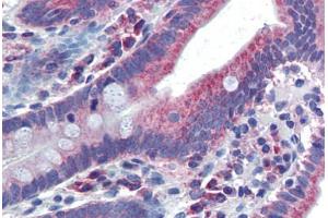 Immunohistochemistry (Paraffin-embedded Sections) (IHC (p)) image for anti-Nuclear Receptor Subfamily 1, Group I, Member 2 (NR1I2) (AA 108-157) antibody (ABIN6741564)