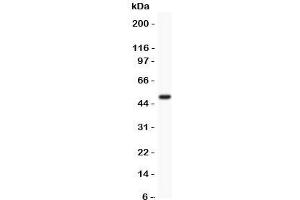 Western blot testing of MCAK antibody and recombinant human protein (0. (KIF2C Antikörper  (AA 531-725))