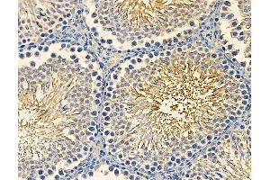 ABIN7094986 and ABIN7099042 at 1/100 staining rat testis tissue by IHC-P.