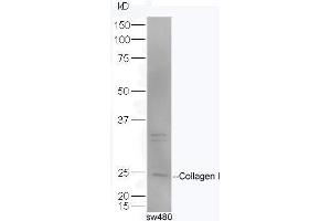 SW480 lysates probed with Rabbit Anti-Pro-Collagen I Polyclonal Antibody, Unconjugated  at 1:5000 for 90 min at 37˚C. (Collagen Type I Antikörper  (AA 1321-1400))