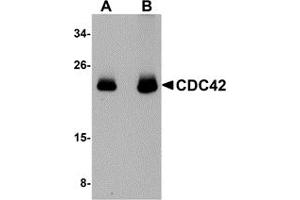 Western Blotting (WB) image for anti-Cell Division Cycle 42 (GTP Binding Protein, 25kDa) (CDC42) (N-Term) antibody (ABIN1031310) (CDC42 Antikörper  (N-Term))
