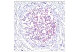 Image no. 1 for anti-V-Raf-1 Murine Leukemia Viral Oncogene Homolog 1 (RAF1) (pSer259) antibody (ABIN196618) (RAF1 Antikörper  (pSer259))