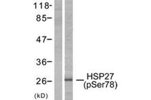 Western blot analysis of extracts from HeLa cells treated with Ca2+, using HSP27 (Phospho-Ser78) Antibody. (HSP27 Antikörper  (pSer78))